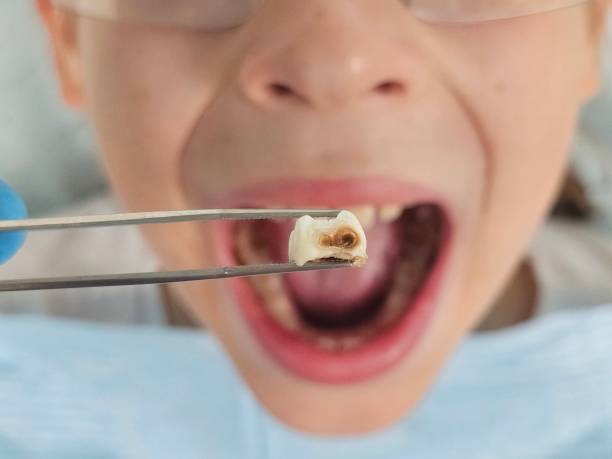 Best Emergency Dental Surgery in Mechanicsville, VA